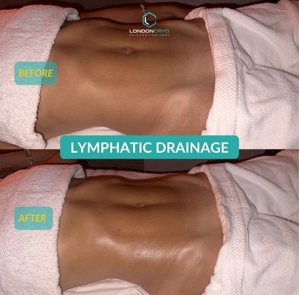 How Often to Get Lymphatic Drainage Massage
