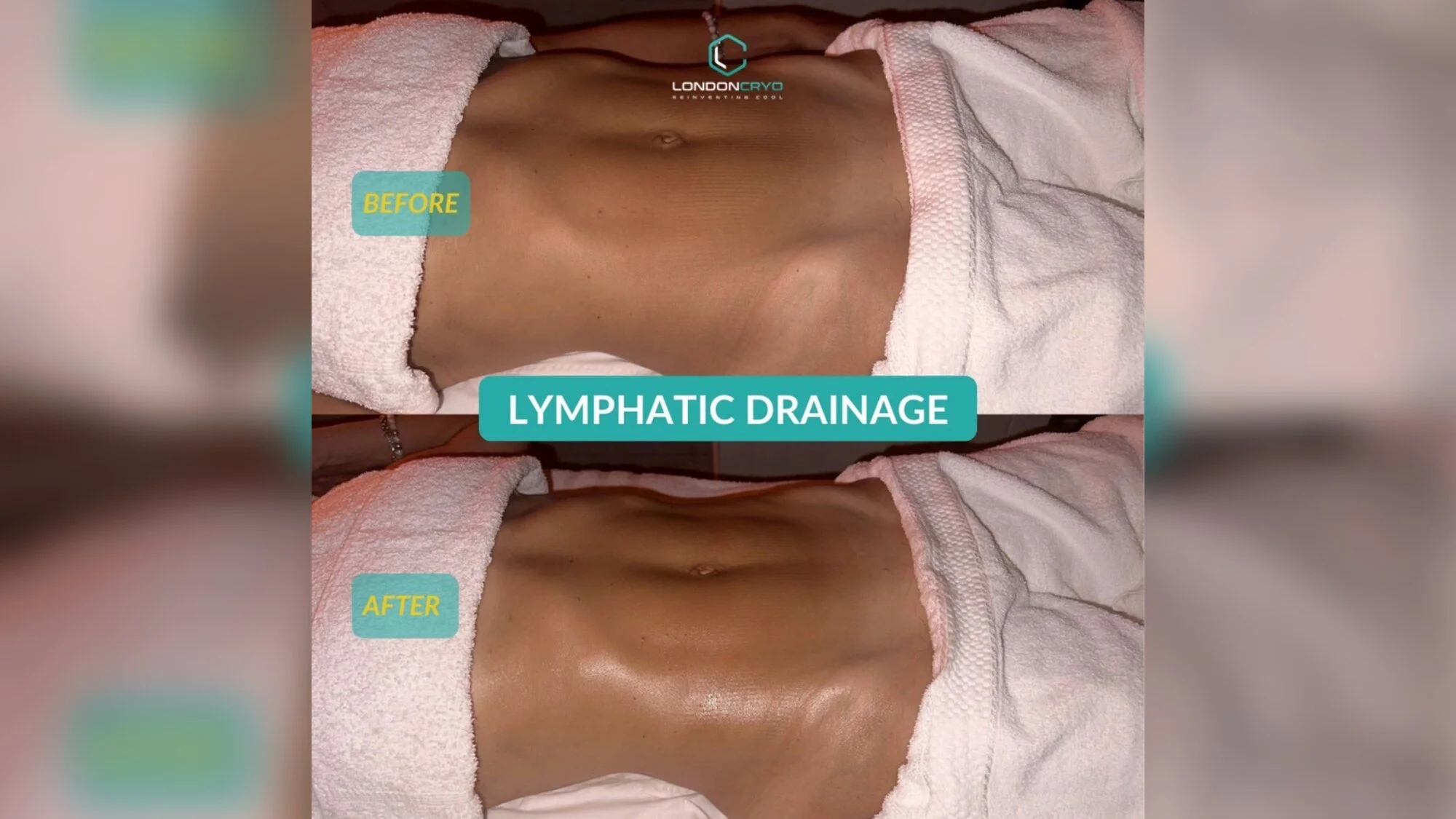 What Happens During a Lymphatic Drainage Massage?