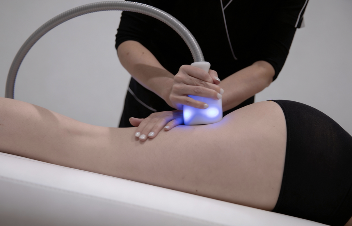 CryoSlimming treatment on the thigh at LondonCryo