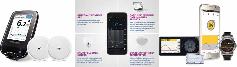Glucose Monitoring CGM Updated — Thriveabetes