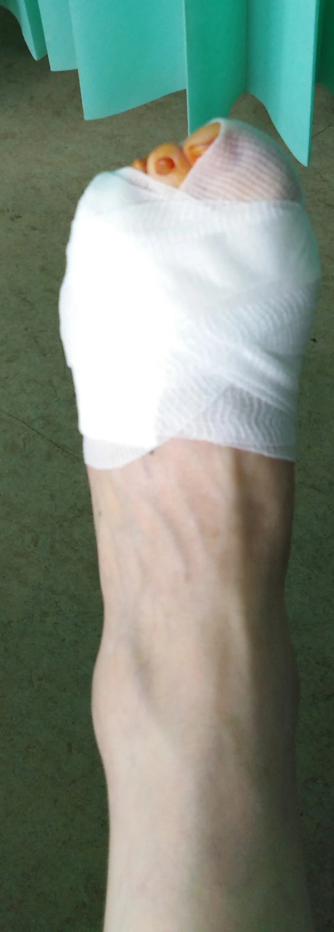 Photo credit Aileen O’Reilly taken shortly after surgery