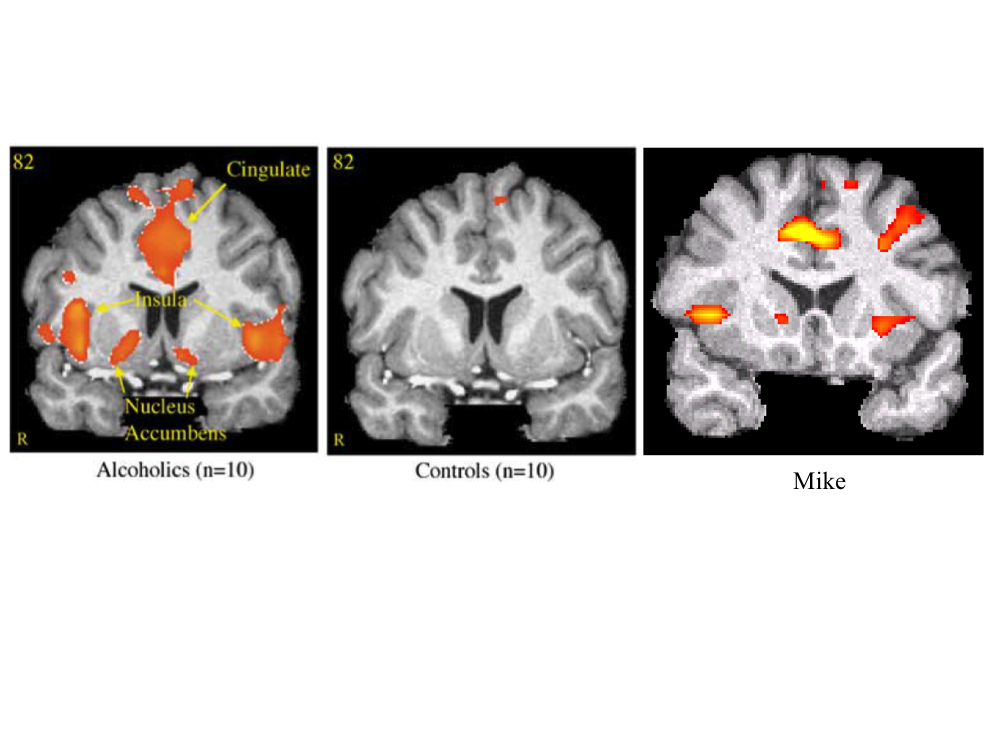 15-Mike Pond brain scan.jpg