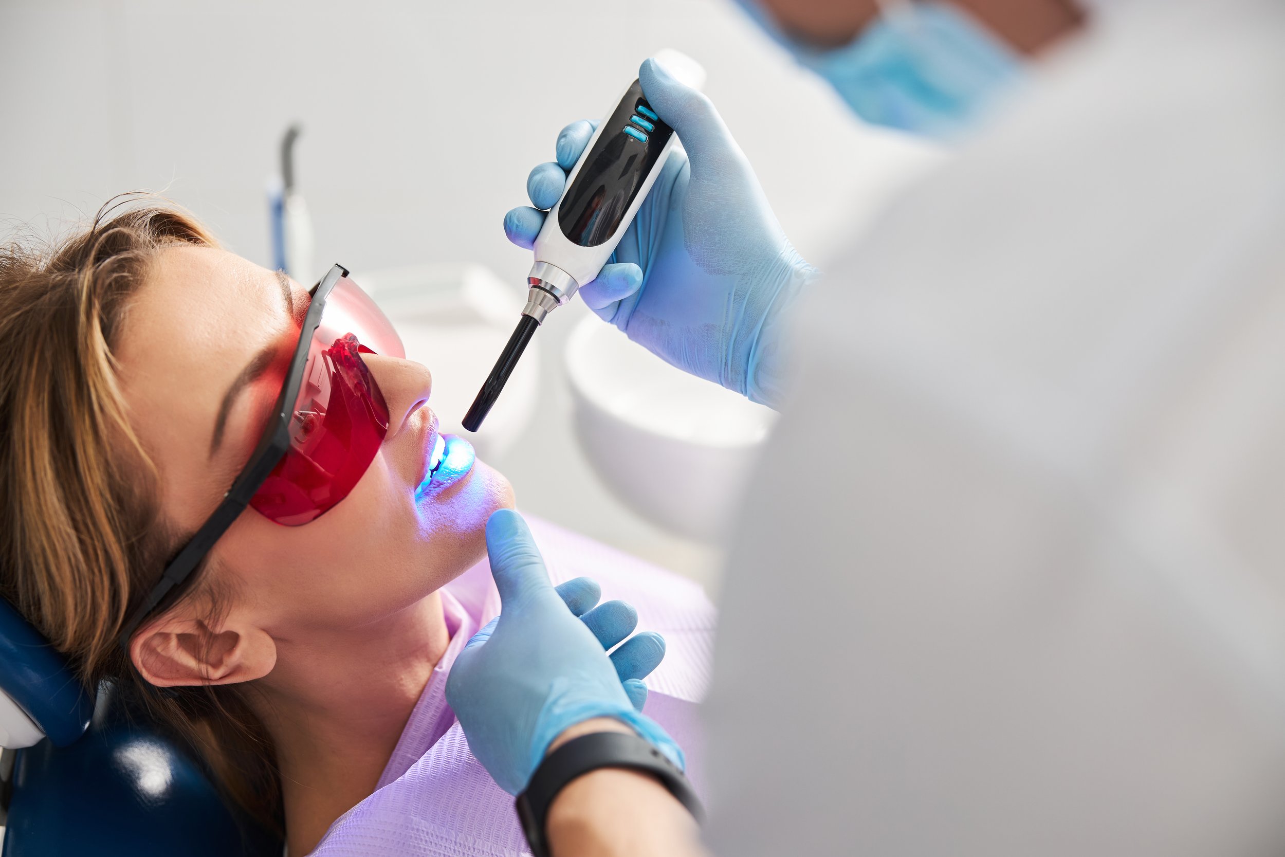 Who Should Get Dental Sealants?
