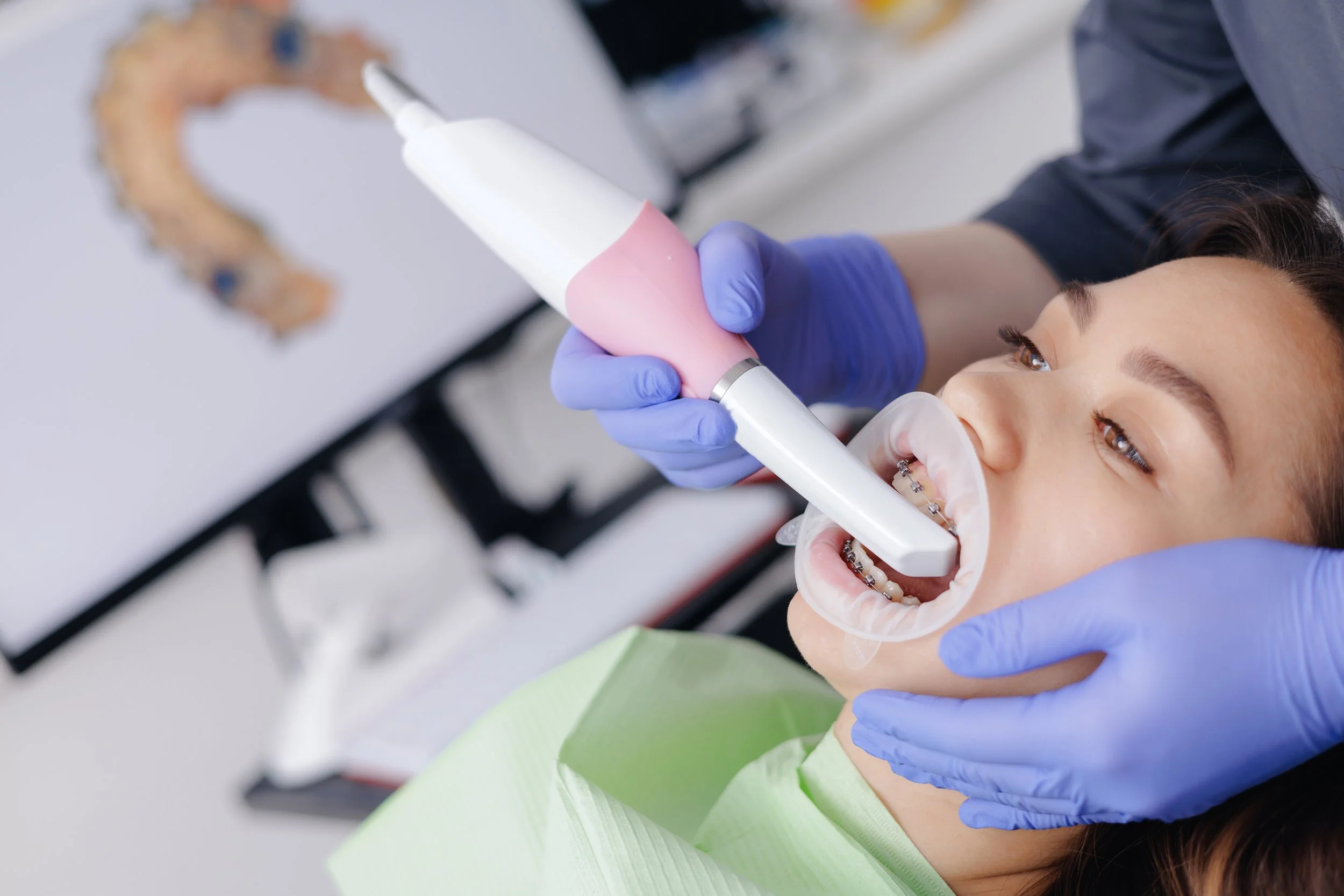 What Are Intraoral Cameras Used For?