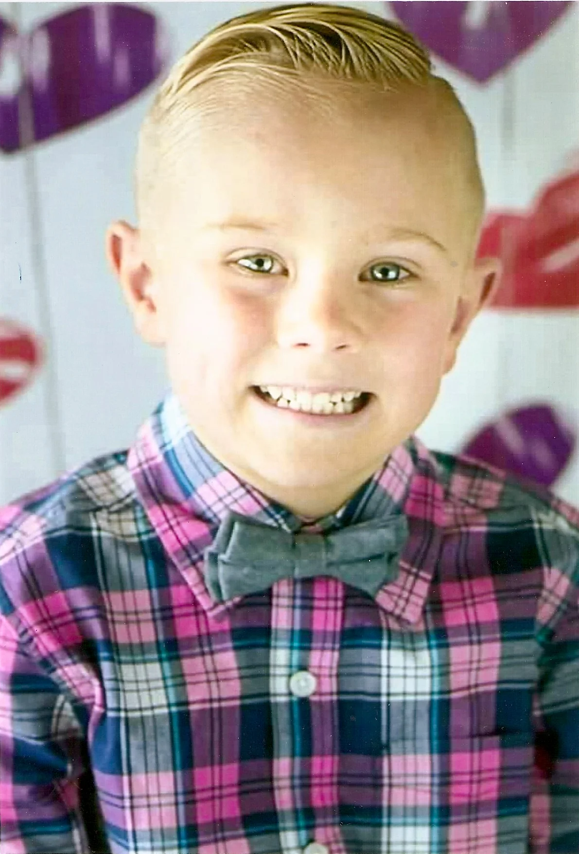 Baine Brady Bobka - Genetic Defect Identified