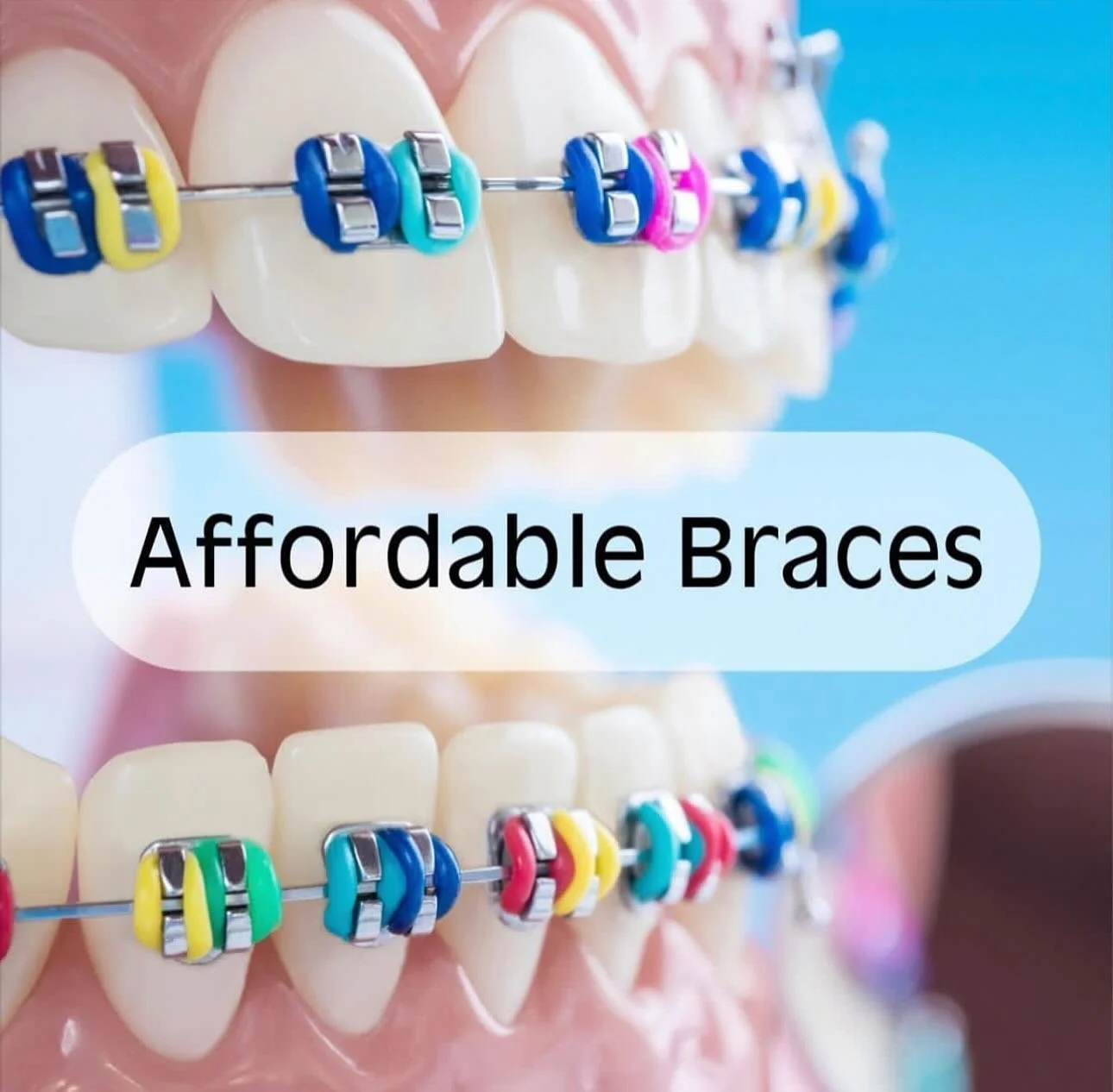 Call us today @ 949-273-8900 to take advantage of our best summer specials! 😁🦷✨