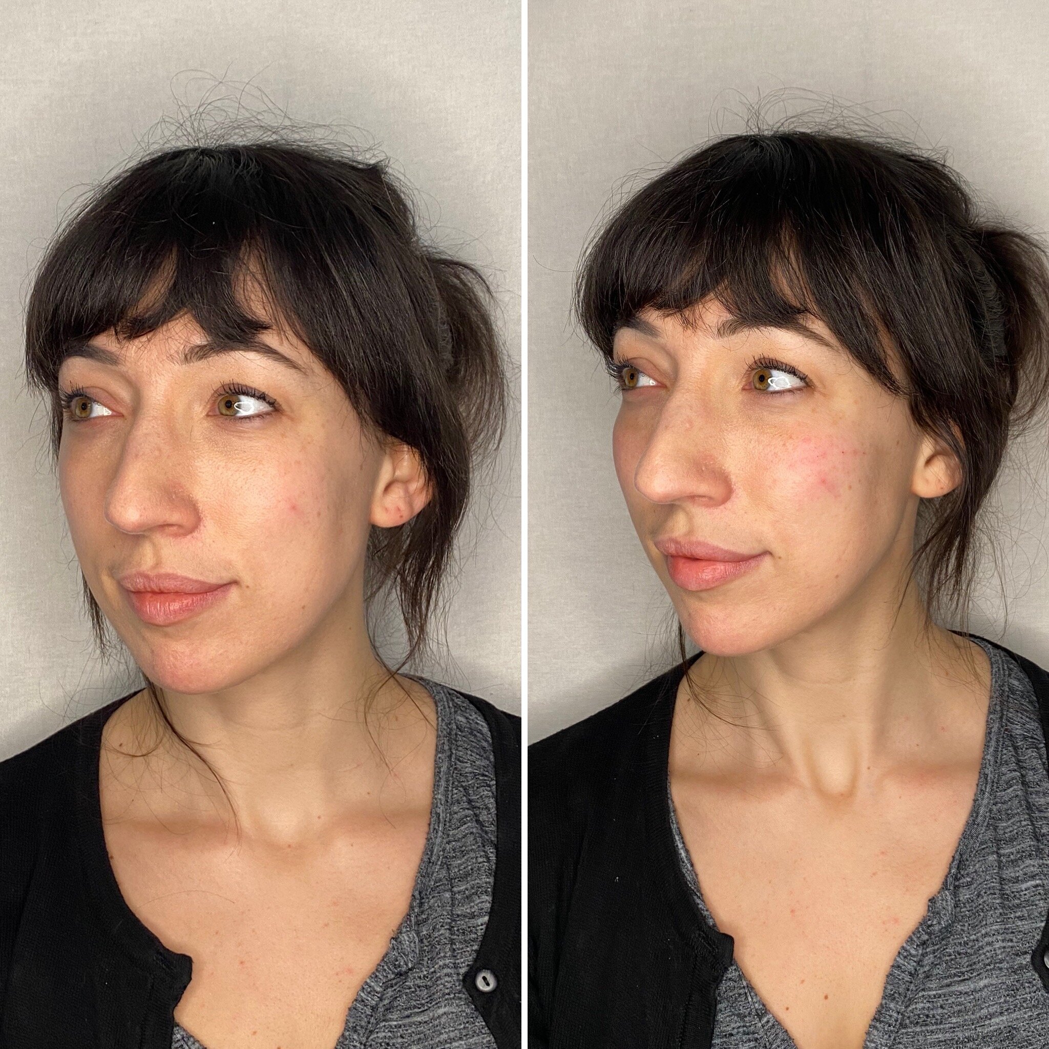 Cheekbones 45 degree 1