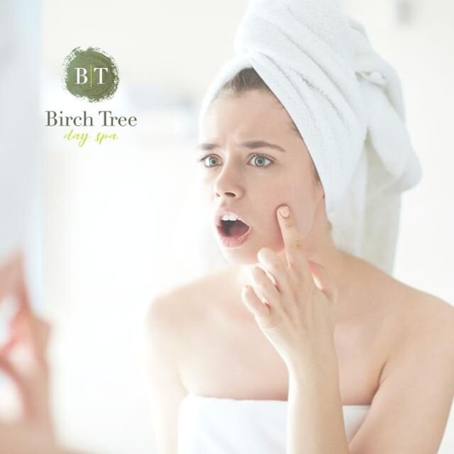 STOP! Step away from the zit! Incorrect popping can lead to infections, scarring, and damage. Best to leave it to the professionals.⁠
⁠
We're here to help you decide which service is best for your skin and budget. Call us at 989-0001 today or swing b