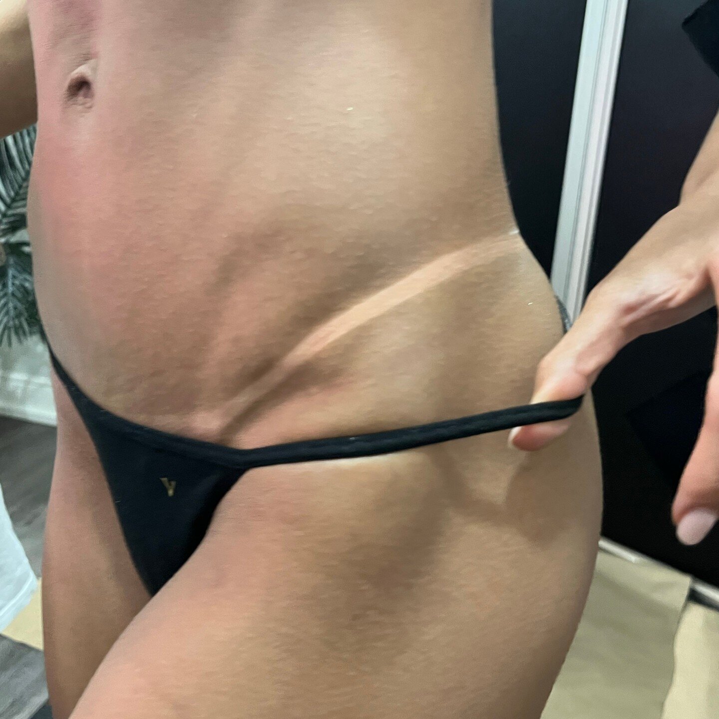 Glowing lines, no sun required! ☀️💫 Book your spray tan session and say goodbye to uneven tan lines and hello to flawless radiance. 
 
#GlowingLines #SprayTanArtistry #spraytan #truetanmiami