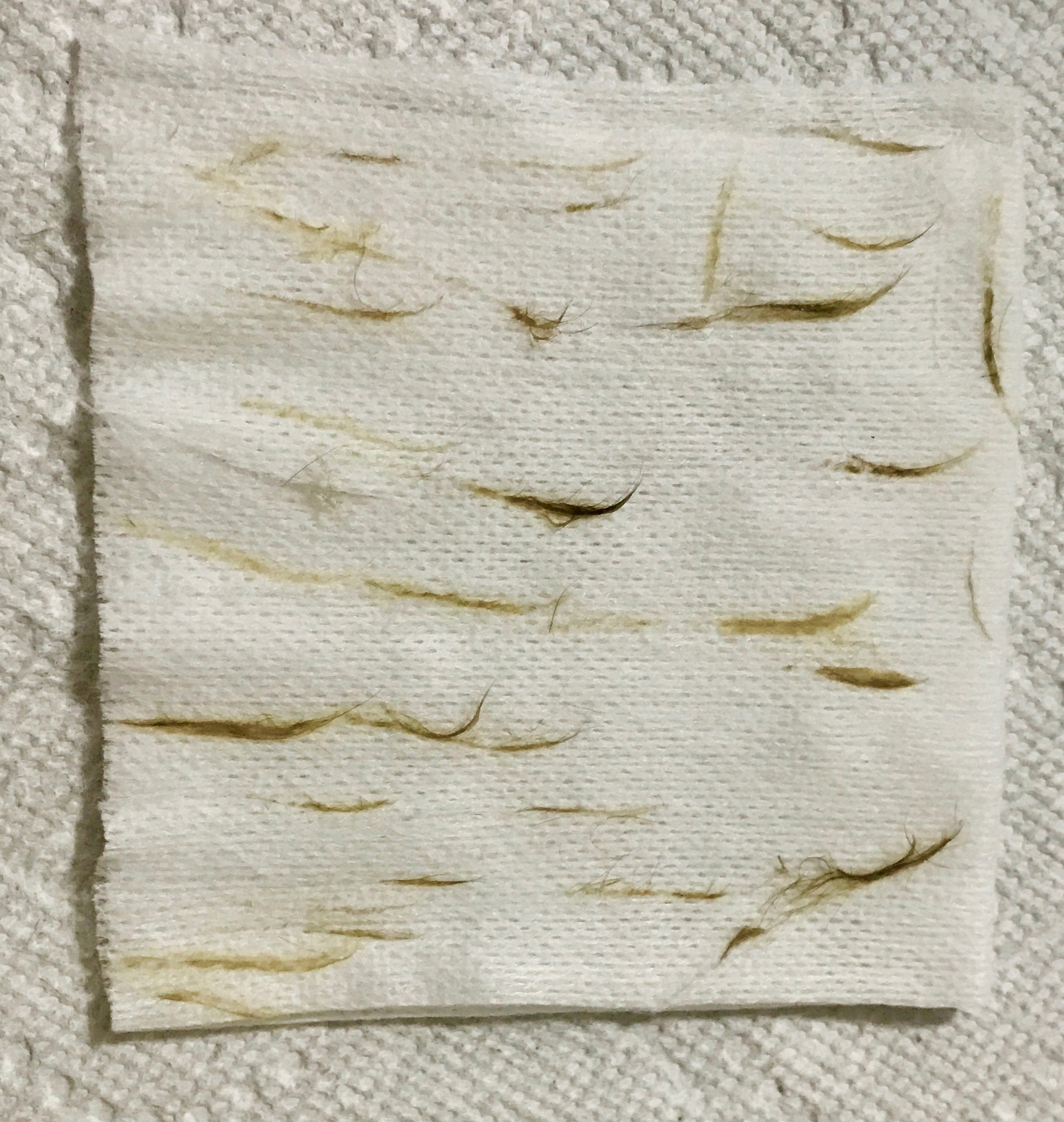 This is what dead skin cells and vellus hair look like when they're scraped off your face! It's gross, but just imagine what it looks like if you leave it on there 😳