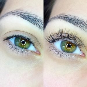 eye-lash-lift-before-after-new-market-300x300.jpeg