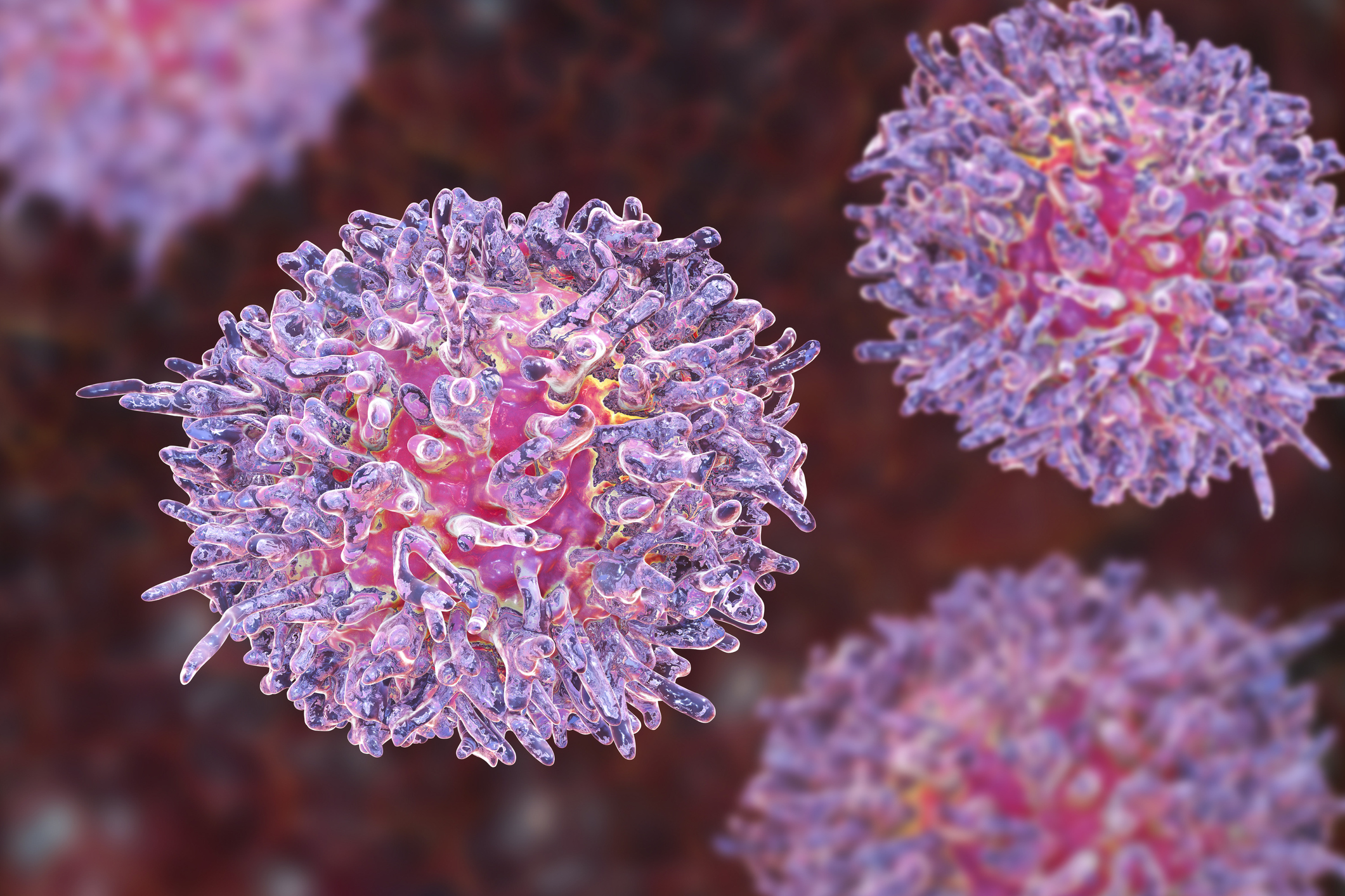 icd 10 code for hairy cell leukemia