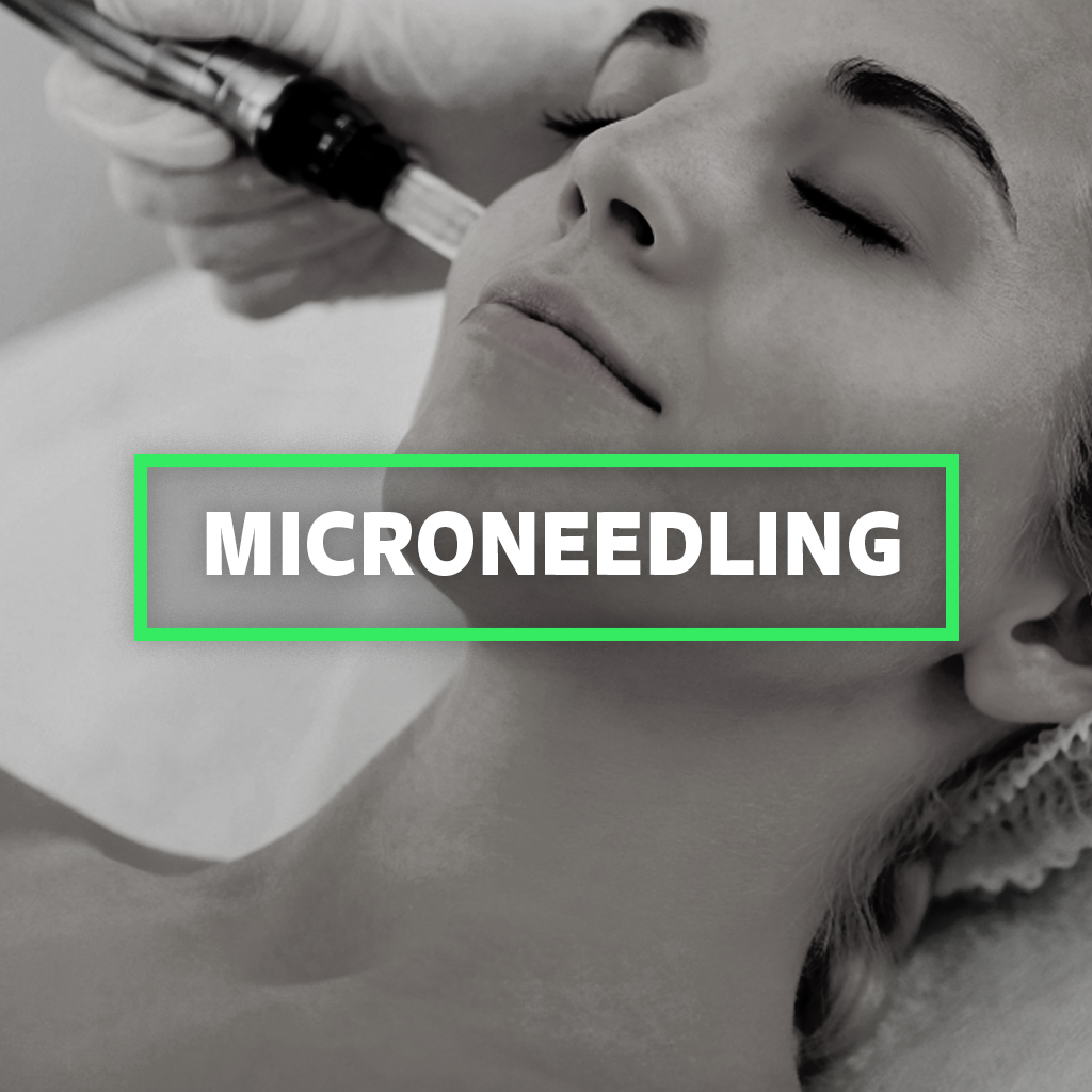 Microneedling at Hela Medical Spa Washington DC