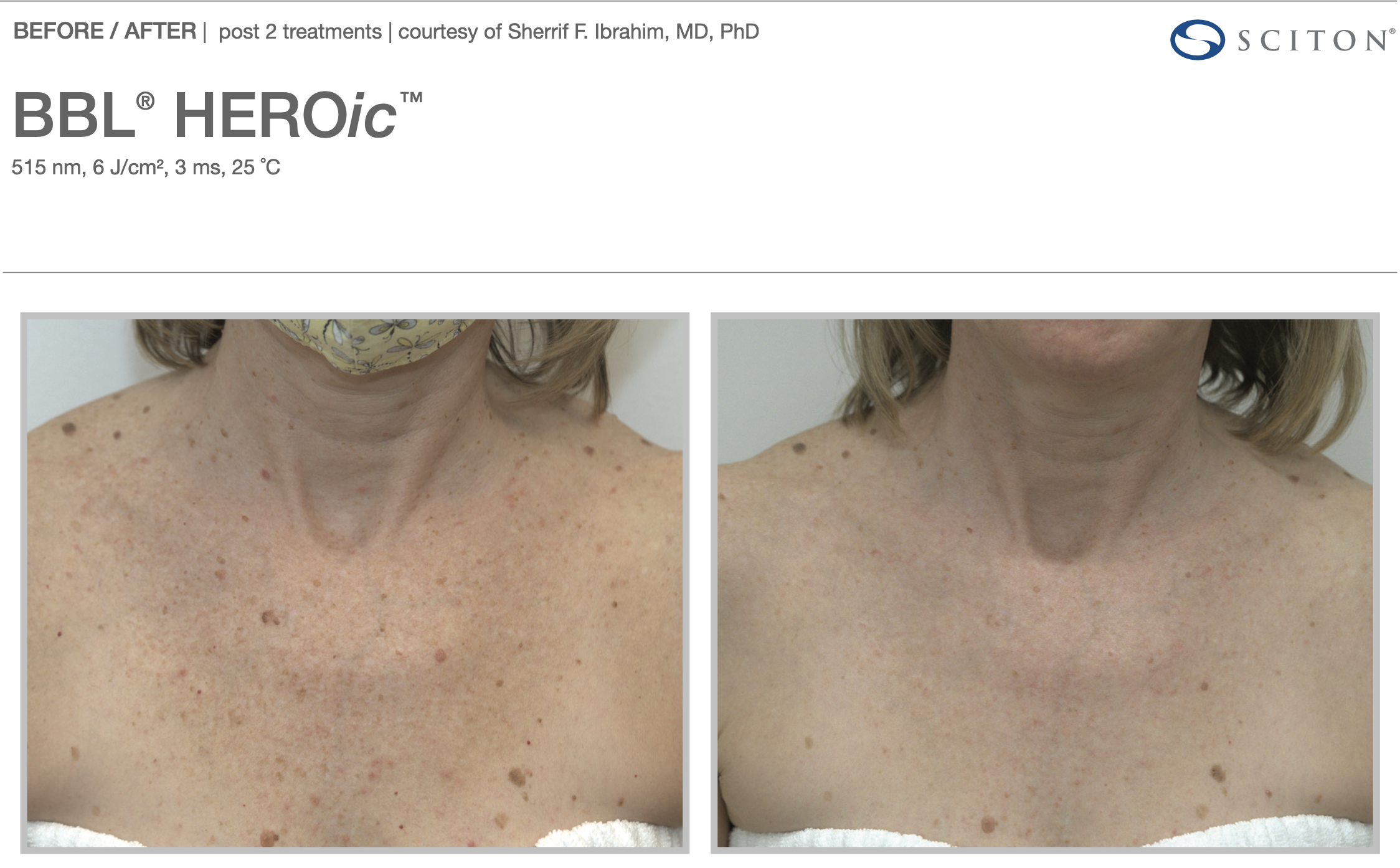 Screenshot 2025-12-08 at 3.15.39 PM.png