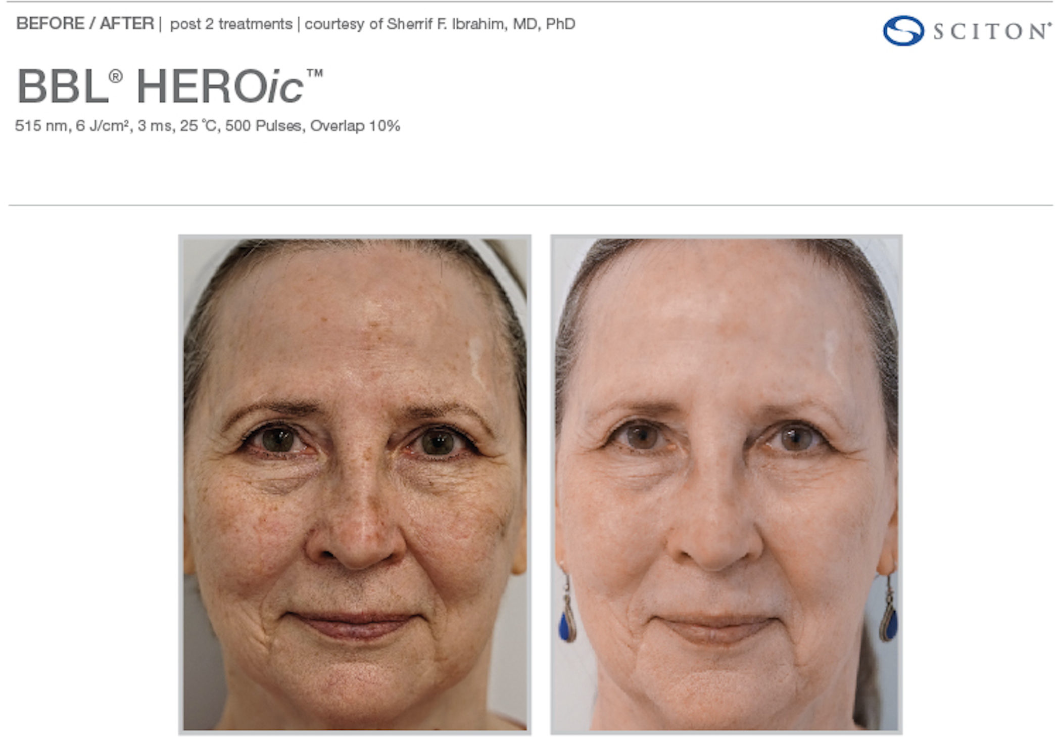 Screenshot 2025-12-08 at 3.16.51 PM.png