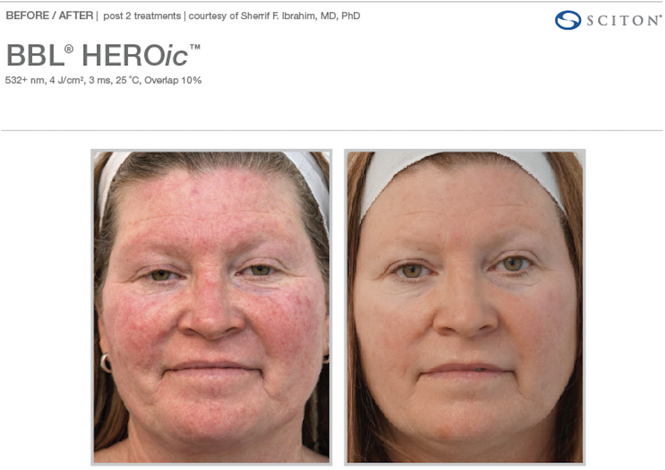 Screenshot 2025-12-08 at 3.17.14 PM.png