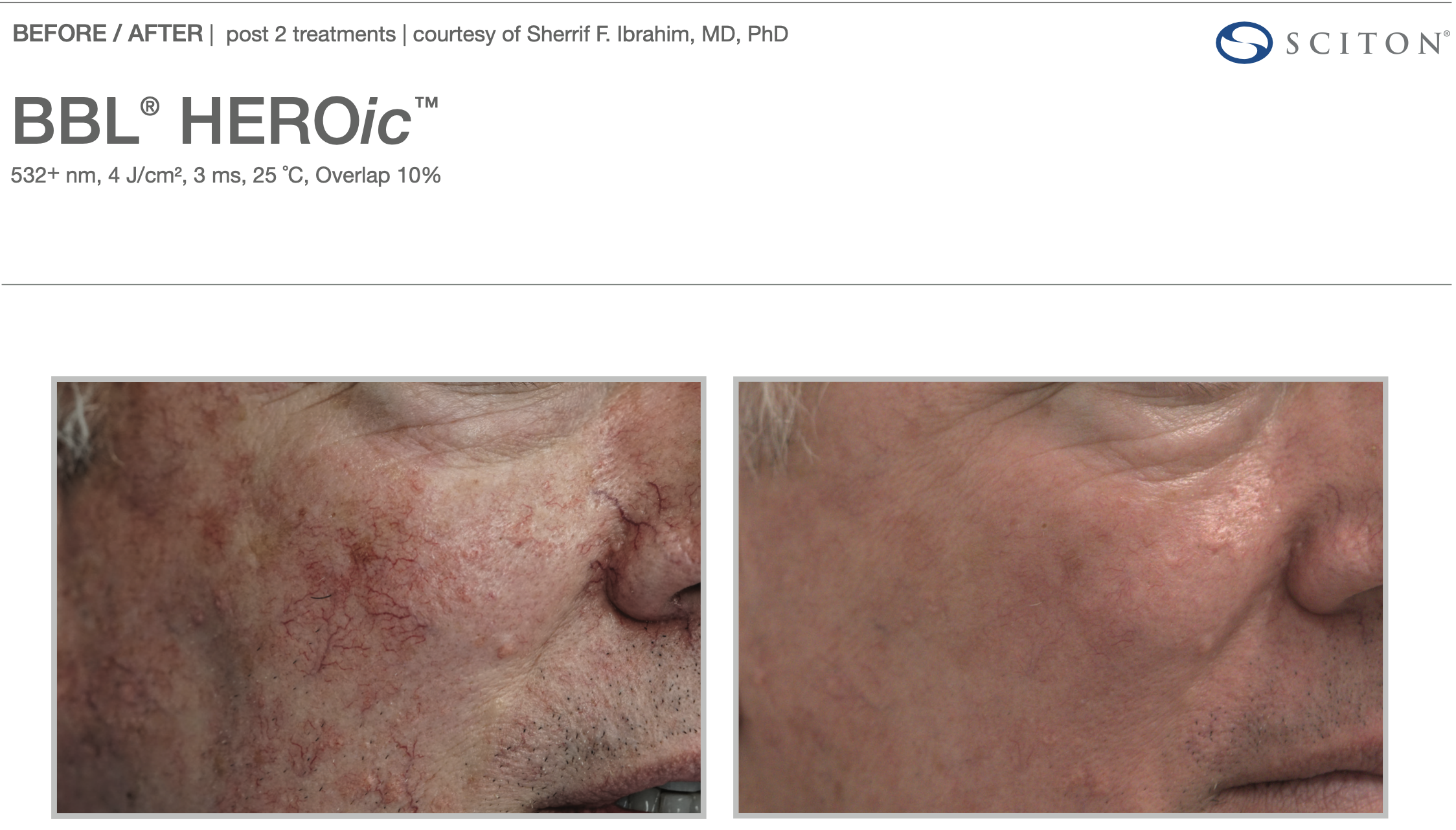 Screenshot 2025-12-08 at 3.17.27 PM.png