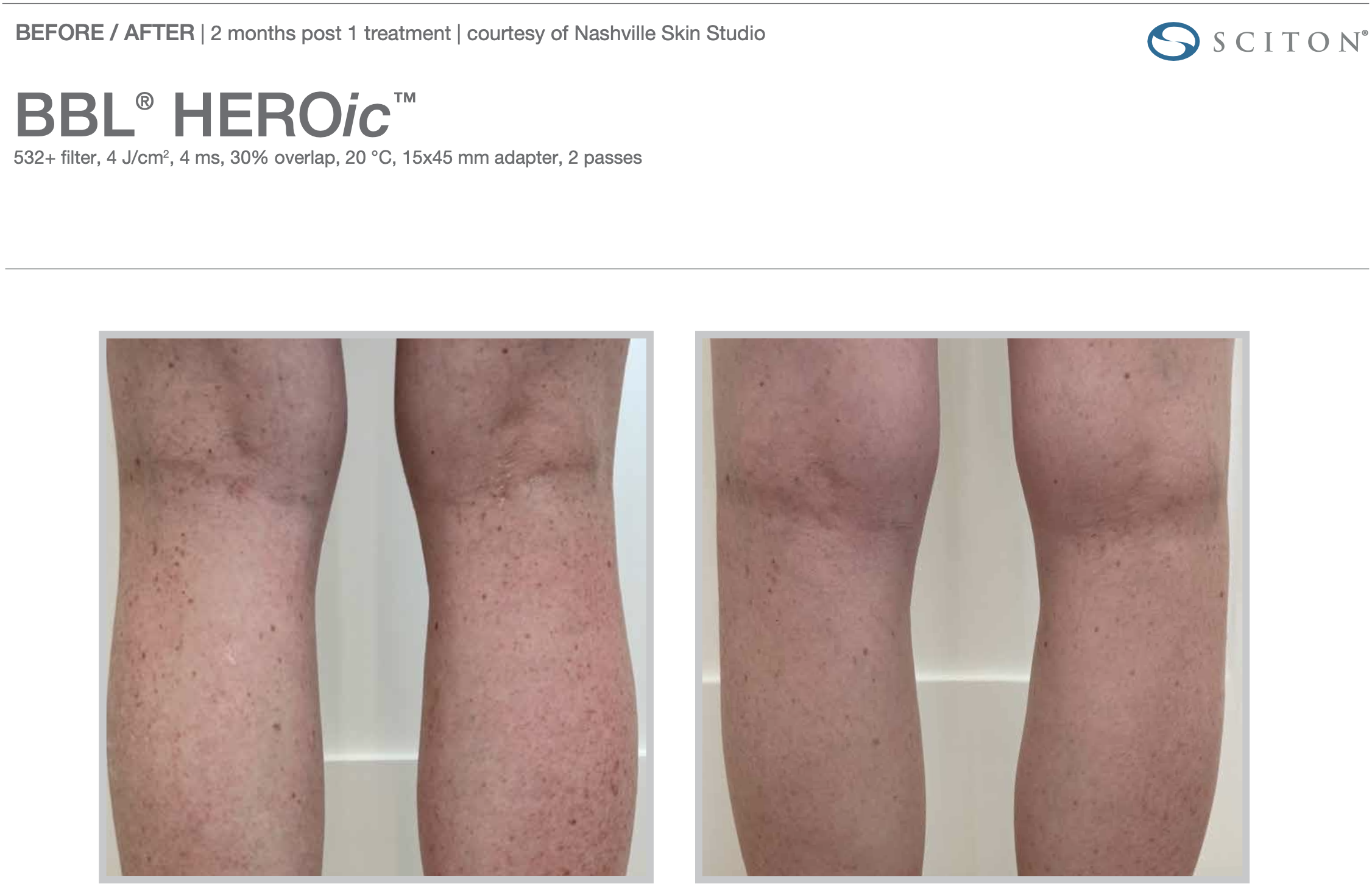 Screenshot 2025-12-08 at 3.18.23 PM.png