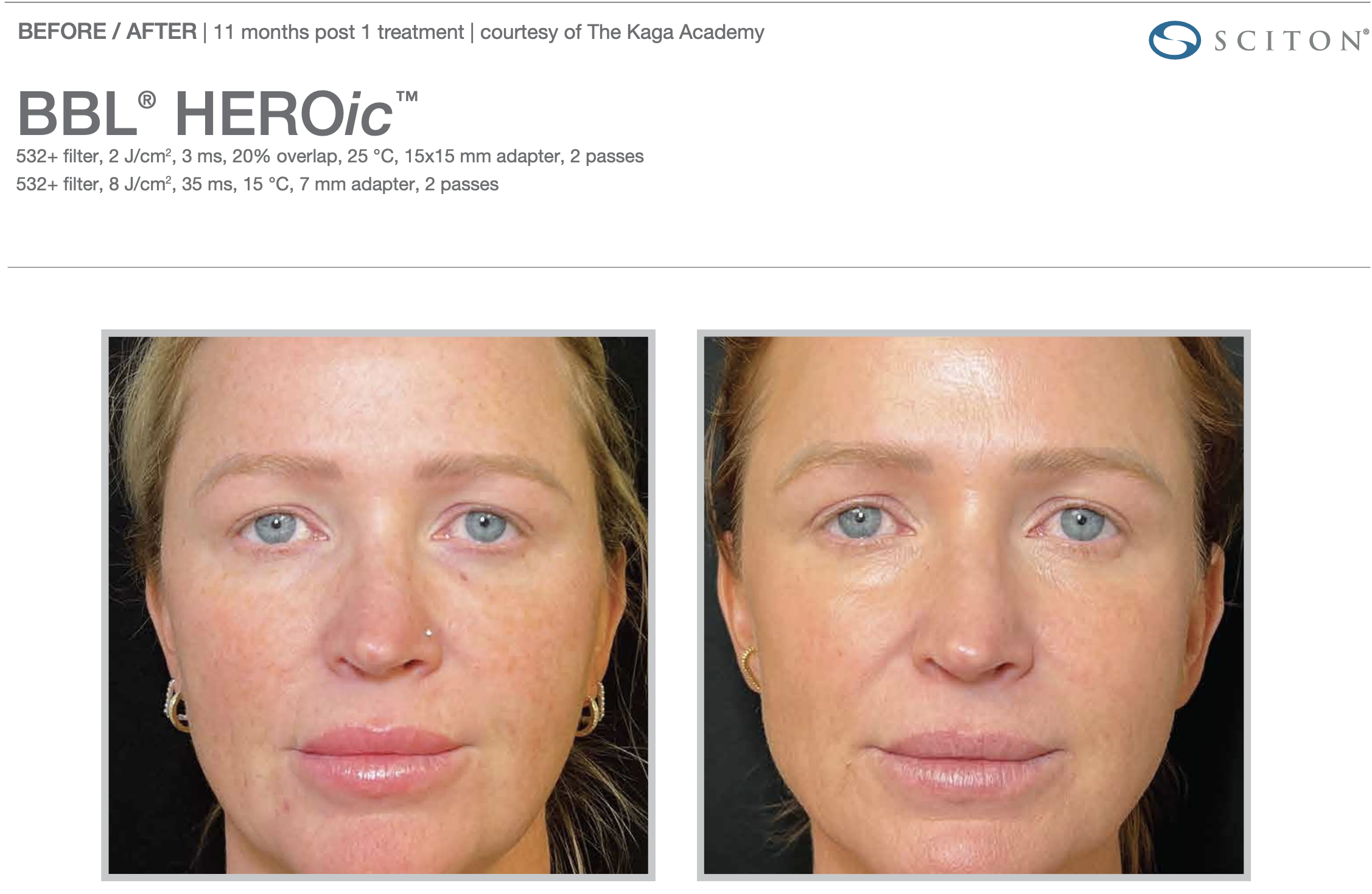 Screenshot 2025-12-08 at 3.20.12 PM.png