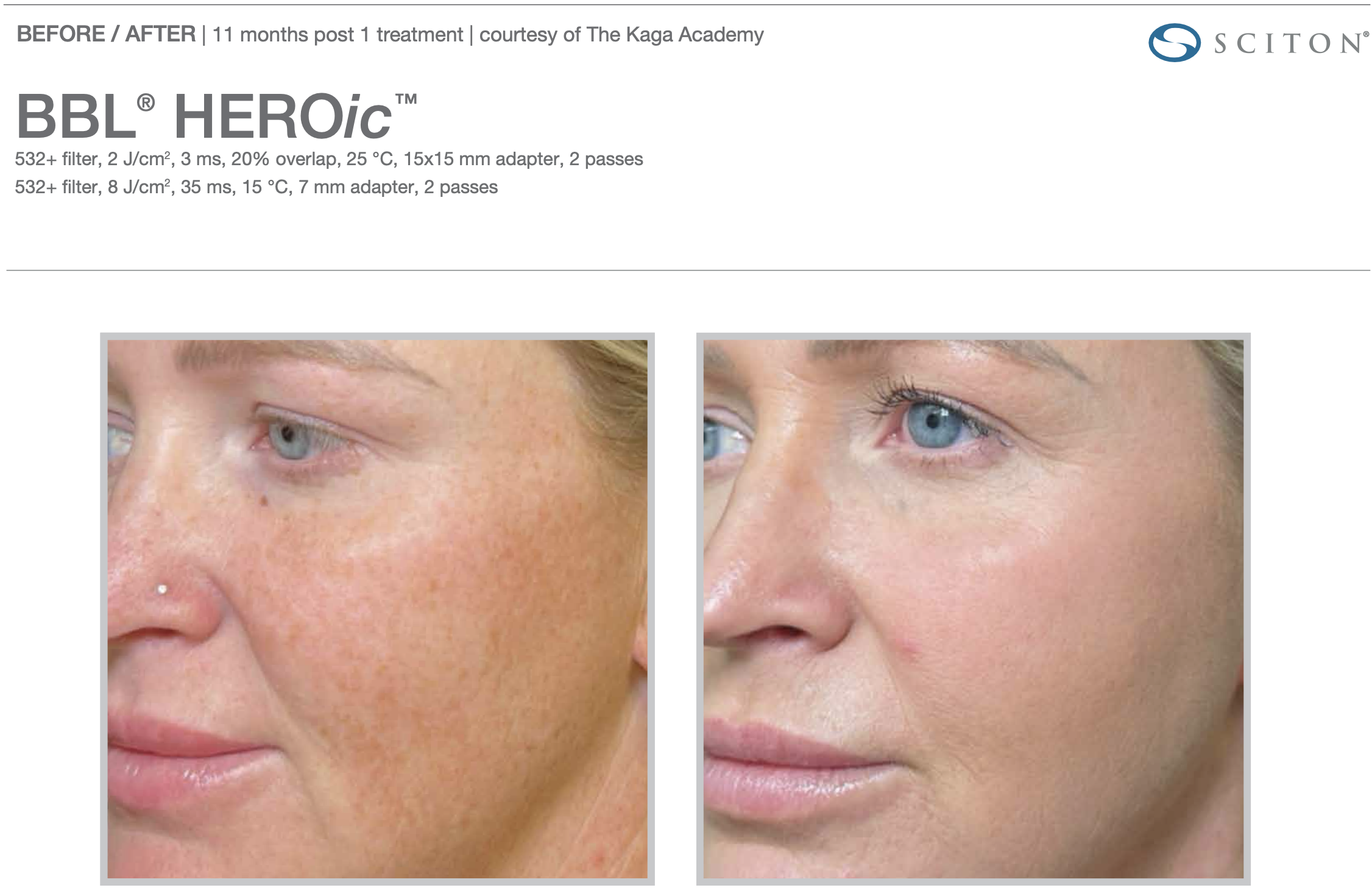 Screenshot 2025-12-08 at 3.20.40 PM.png