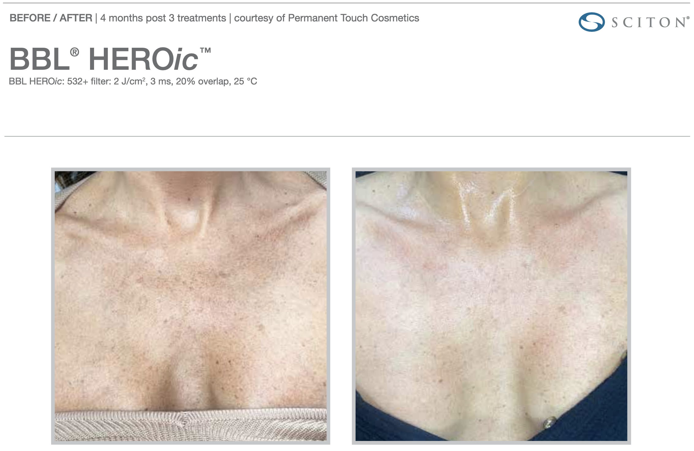 Screenshot 2025-12-08 at 3.21.21 PM.png