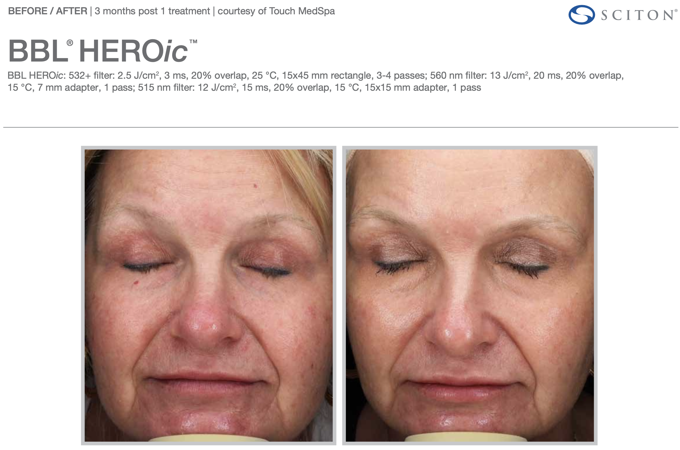 Screenshot 2025-12-08 at 3.21.47 PM.png