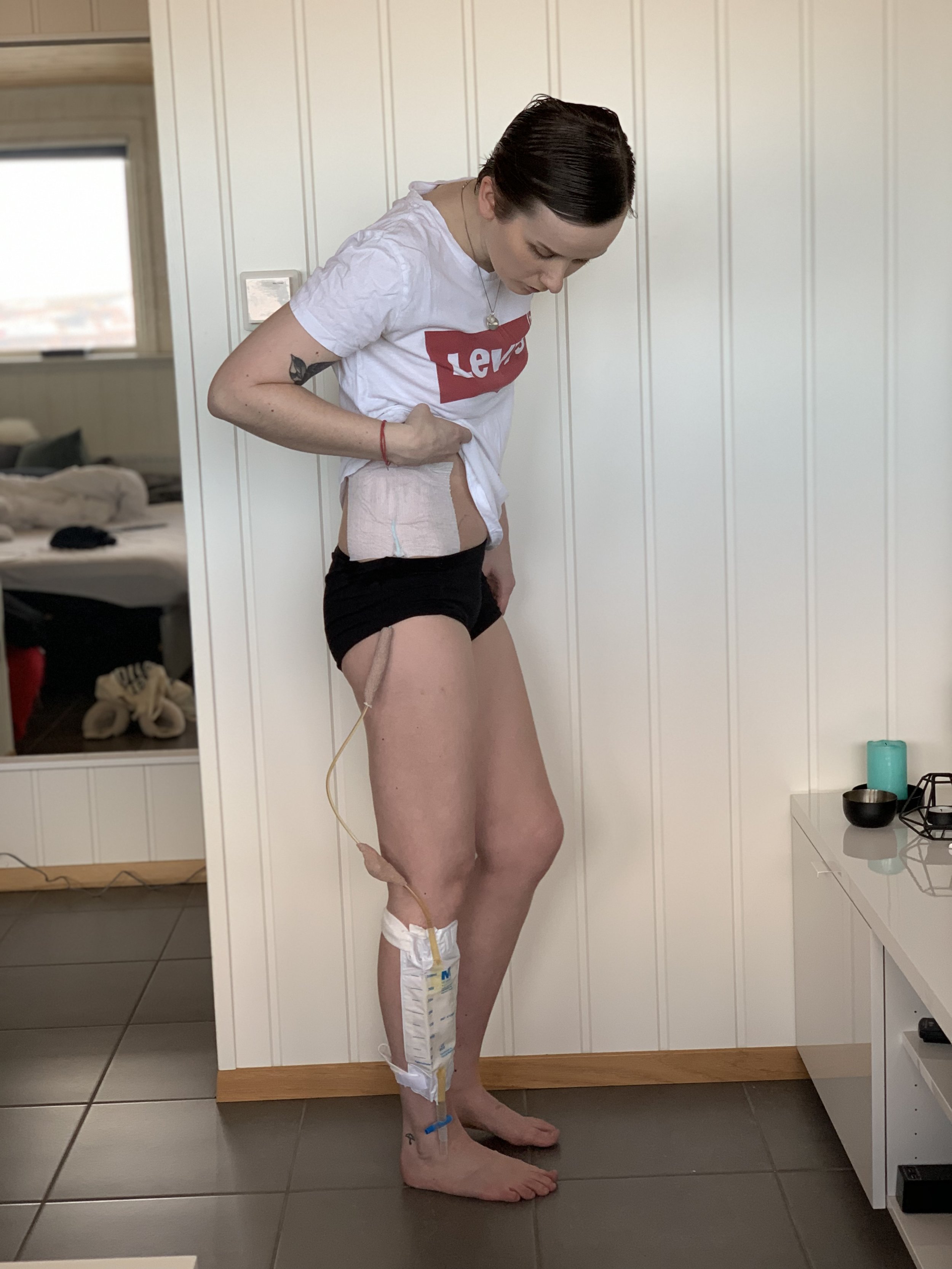 Følg @kreftutenfilter på Instagram