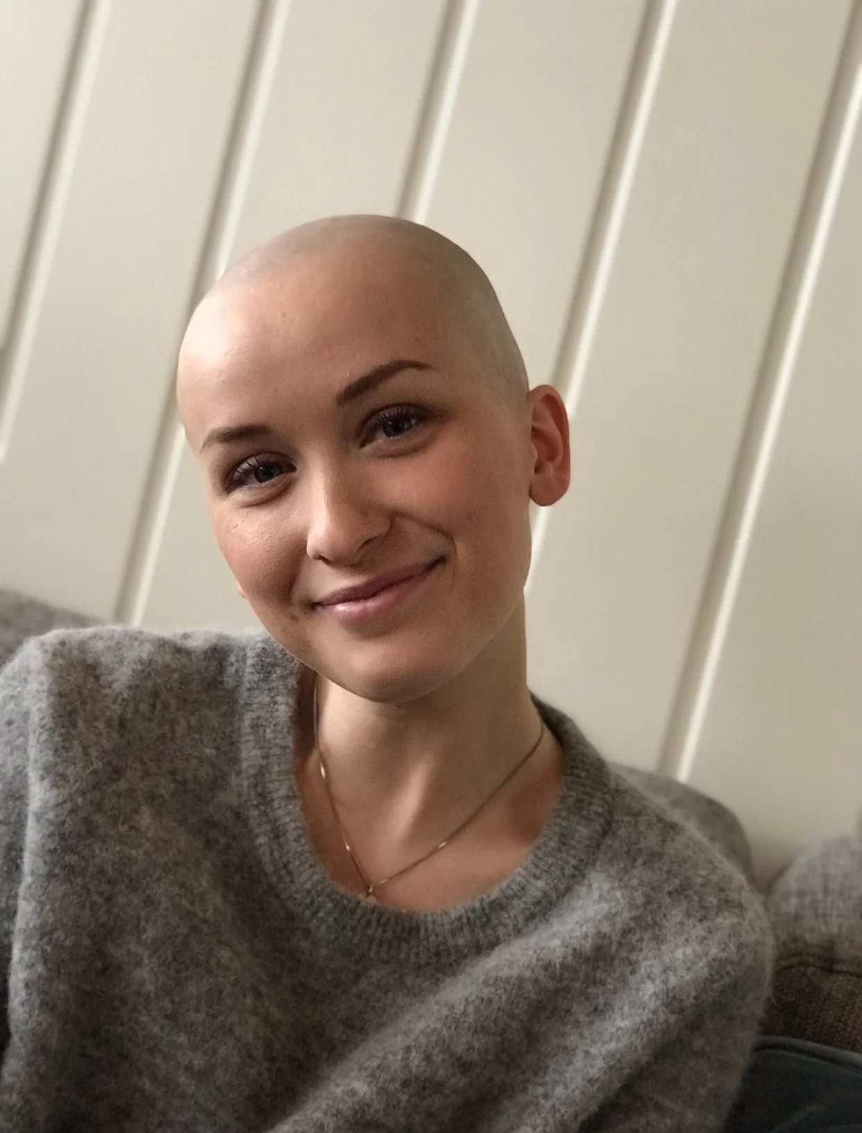 Ett år uten (langt) hår