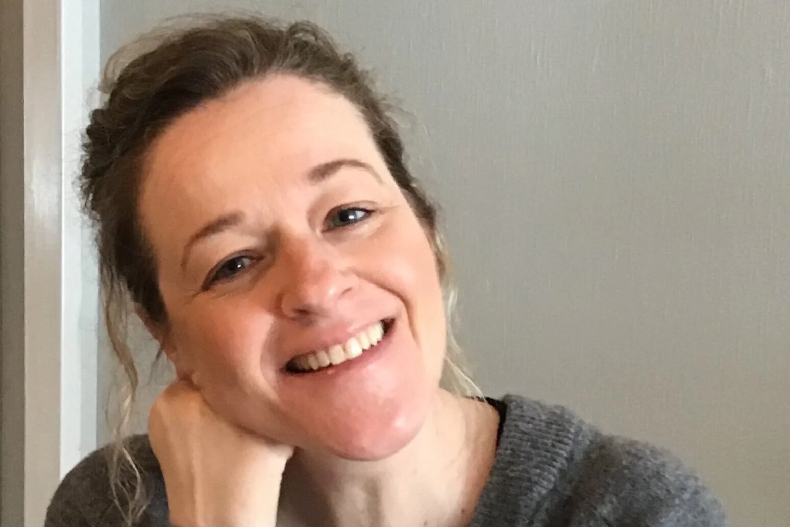 Anne-Cathrine lever med uhelbredelig hudkreft