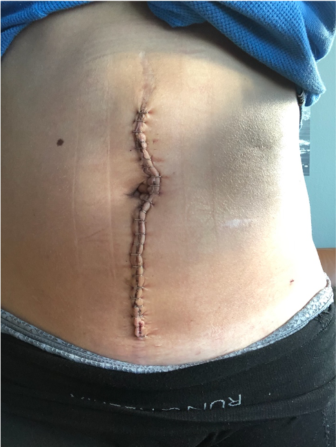 Påan igjen- opp igjen