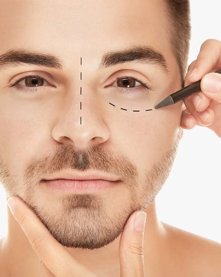 Reconstructive Procedures