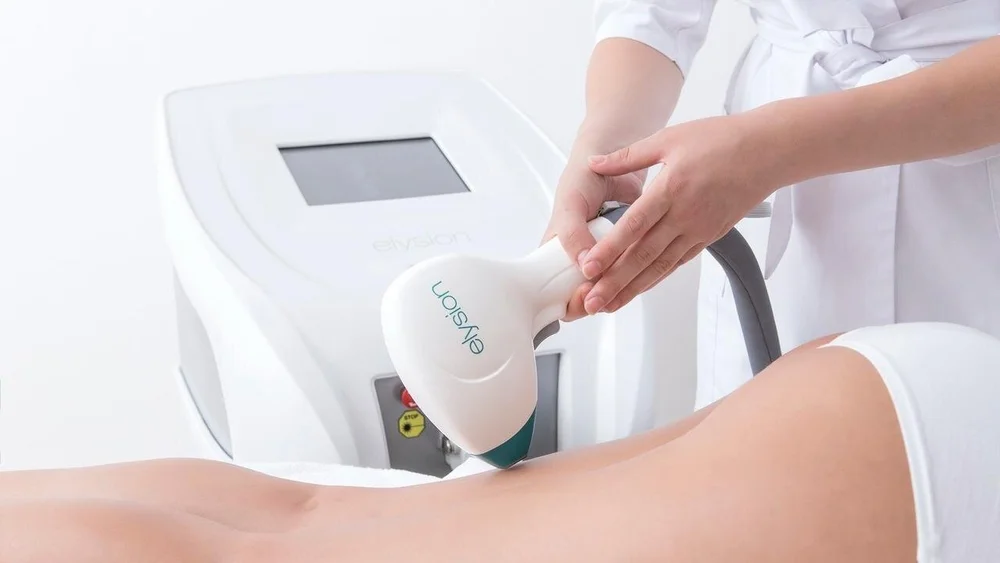 Elysion 3000w Laser Hair Removal — The Beauty Rooms at The Nibblers