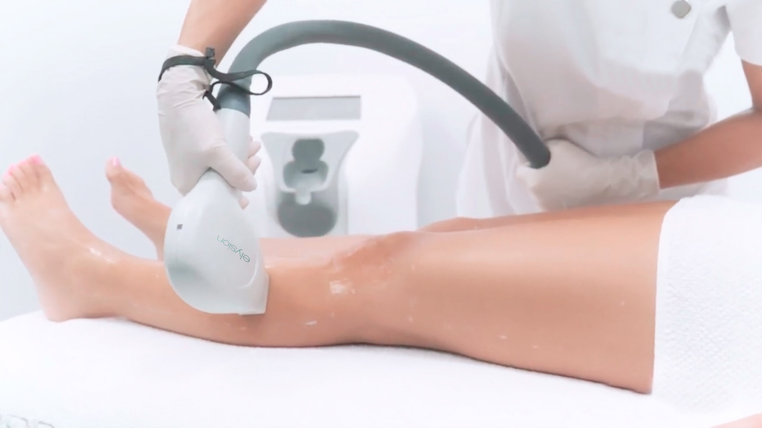 Elysion Pro Diode Laser Hair Removal - Metro Global Device