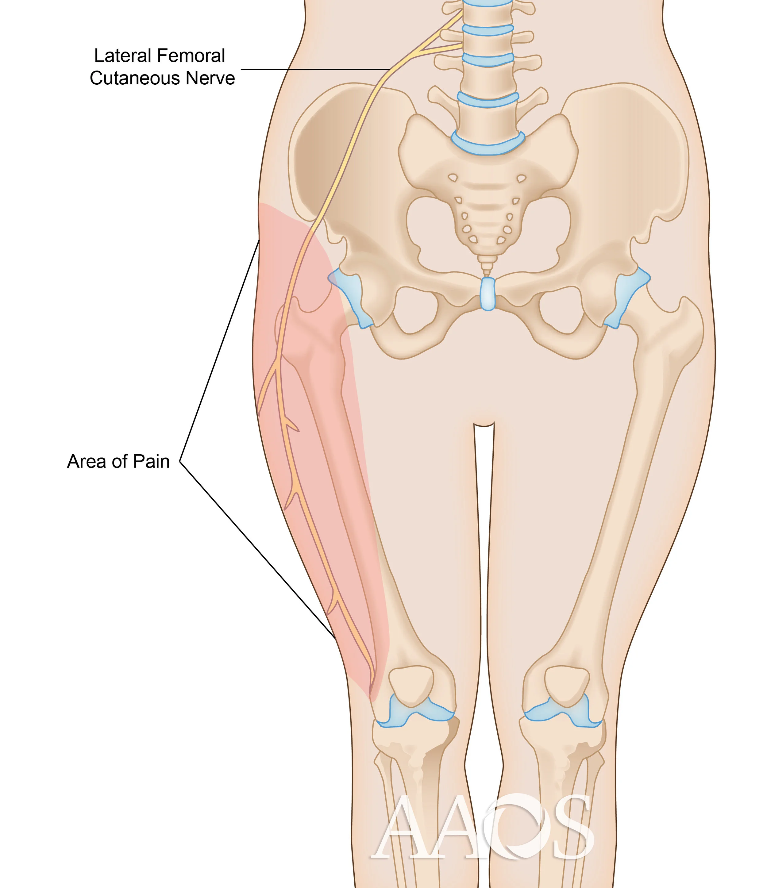 Lateral Femoral Cutaneous Nerve Dermatome