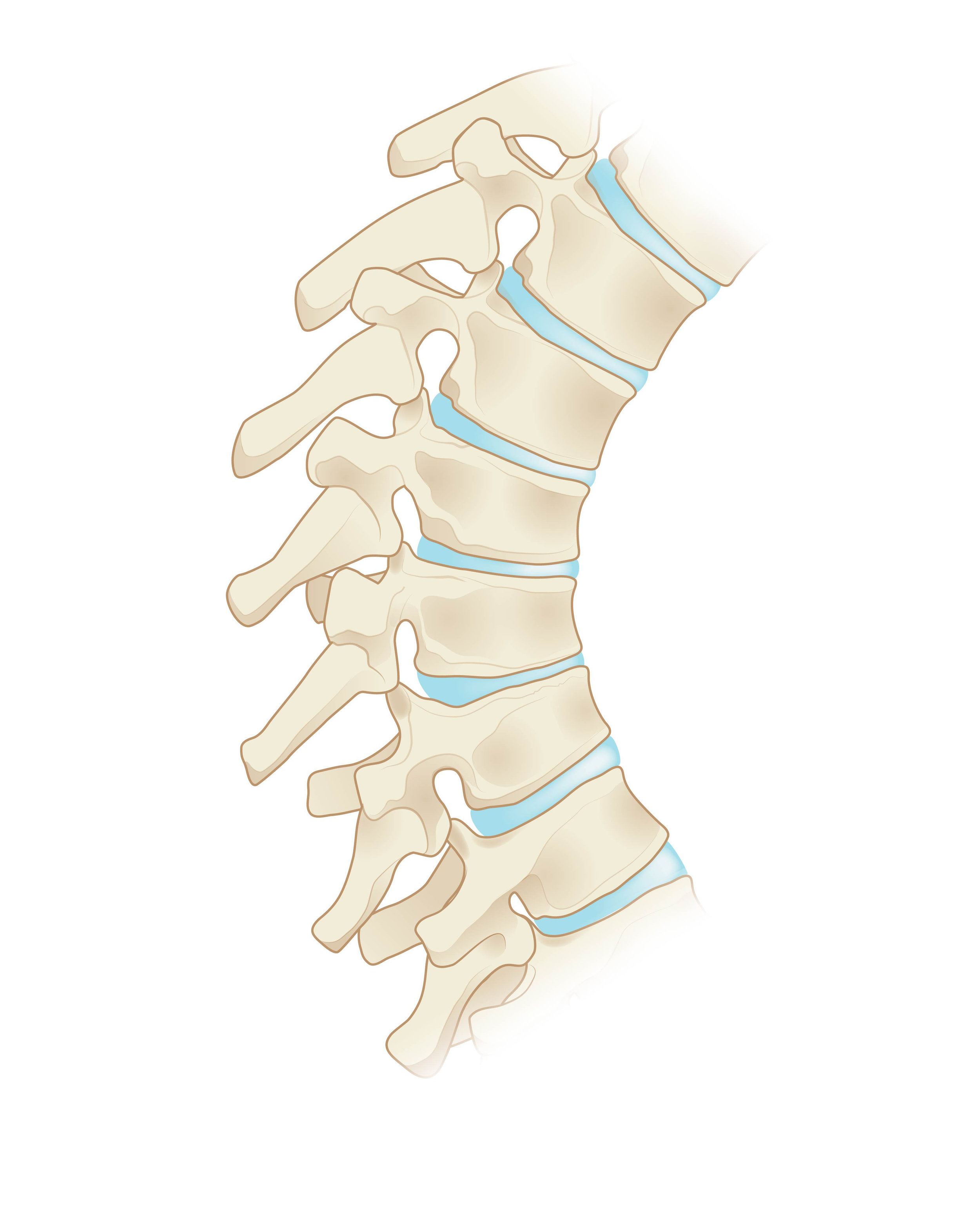 Kyphosis Segment