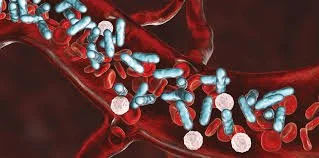 Sepsis: Pathophysiology, Practical Management, and Surviving Sepsis Guidelines