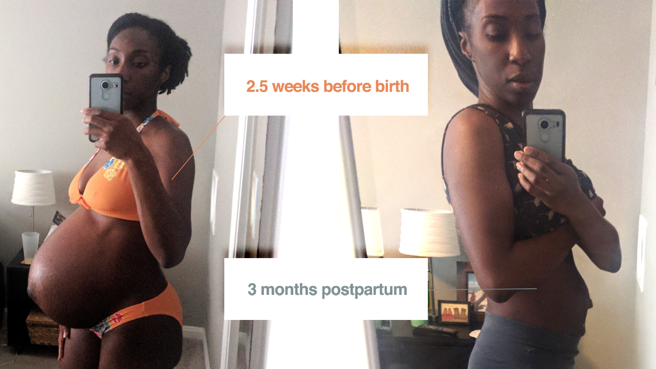 Postpartum Physical Therapy: My Diastasis Story — Well Worth
