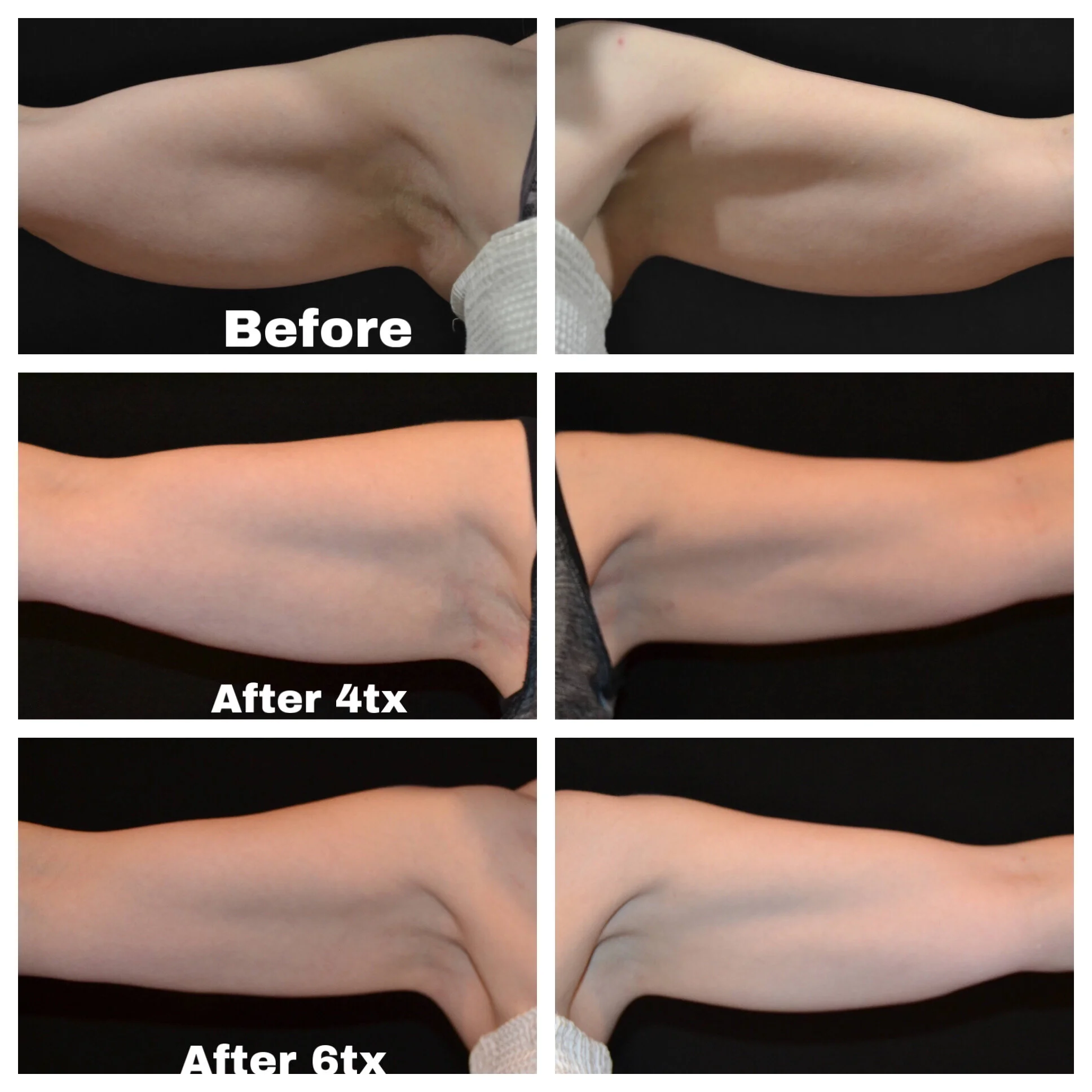 29089868-E0A2-4CD3-A012-BB517C6FDB8D (2).jpeg