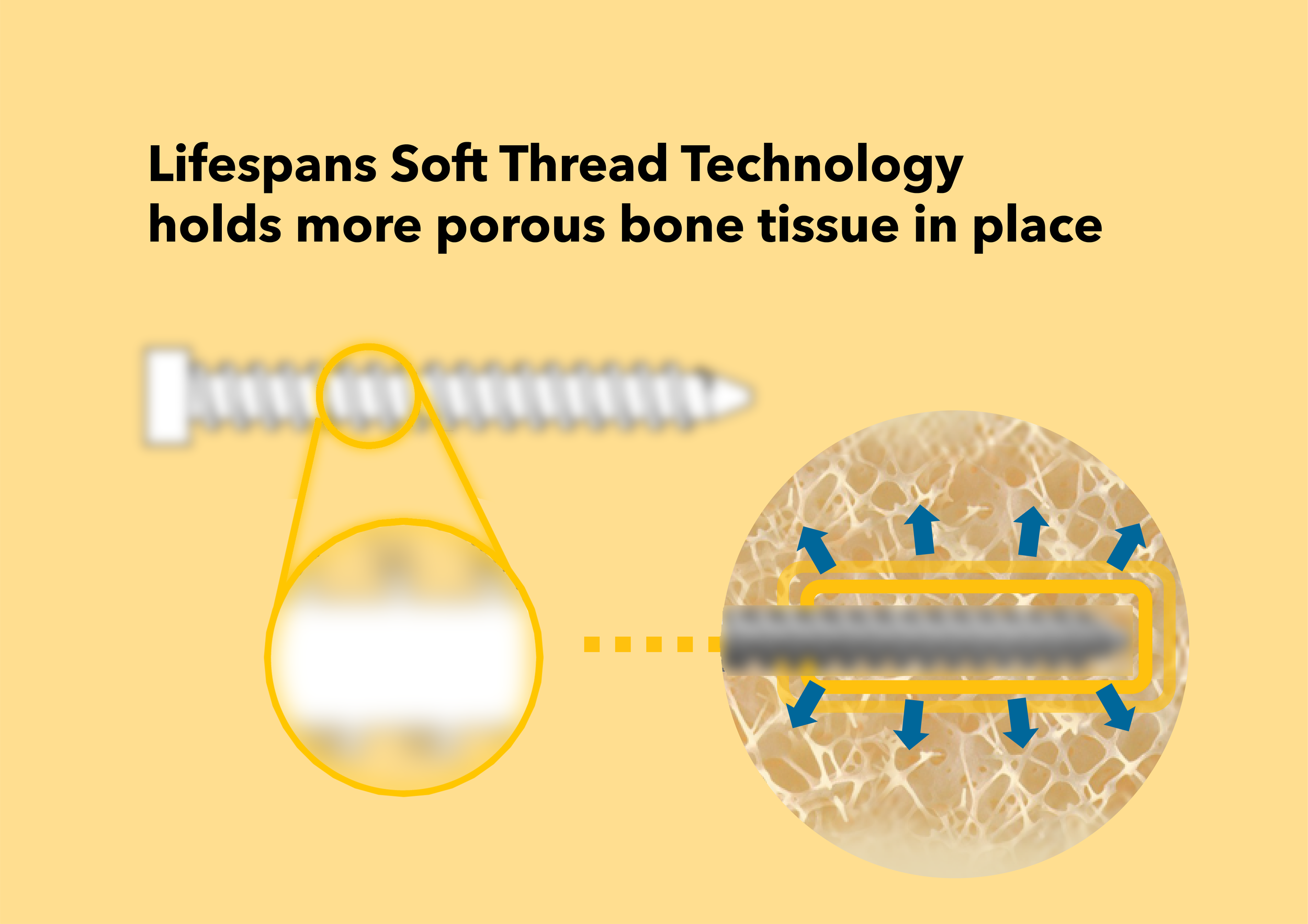 Soft Thread Technology - blur.png
