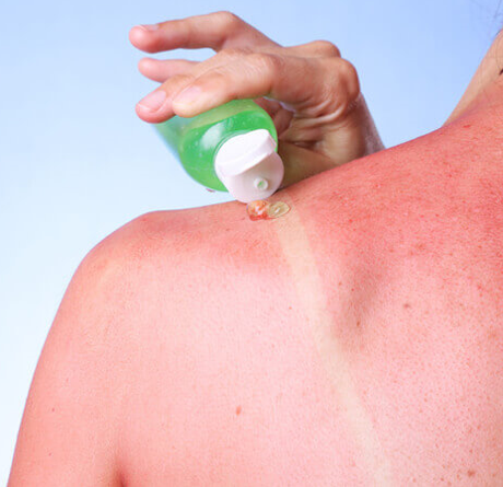Summer Tips &amp; Tricks