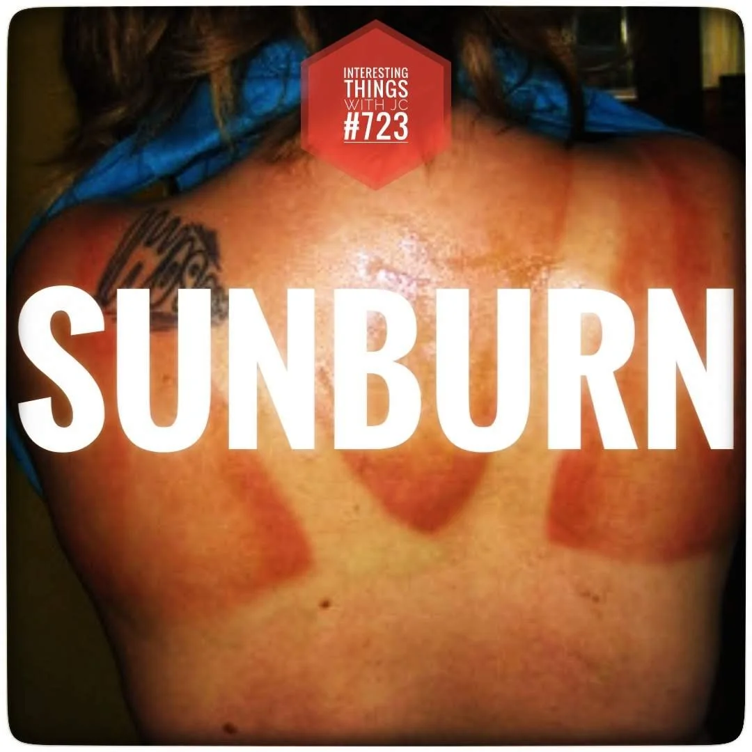 723: "SUNBURN" 723: "SUNBURN"