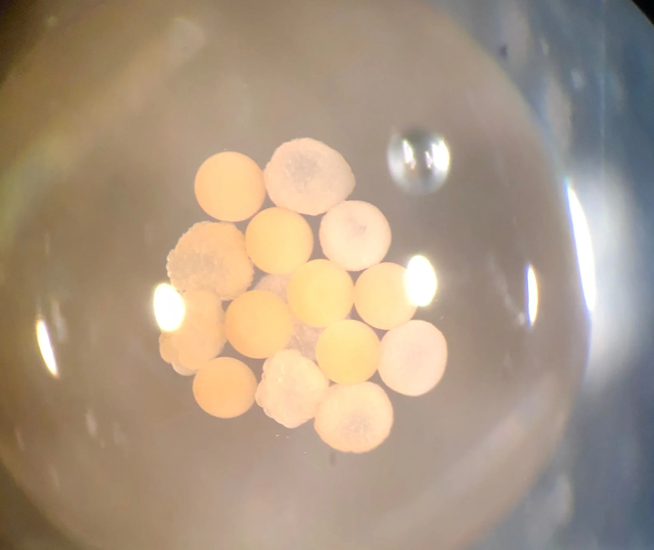 After we cross eggs and sperm from different parent colonies, we quantify fertilization success by viewing the gametes under a microscope. The bumpy, fuzzy-looking dots are fertilized embryos that have begun the process of cell division, while the smooth circles are unfertilized eggs.