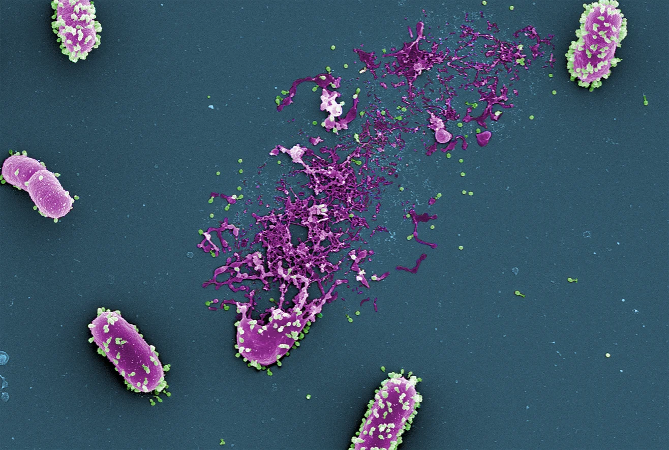 Electron microscopy image of a bunch of bacteriophages (in green) attacking and lysing a bacteria (in purple). This is happening all around you, all the time. Image credit: M. Rohde and C. Rohde (Helmholtz Centre for Infection Research, Braunschweig, Germany) and colorized by Dwayne Roach (Institut Pasteur).