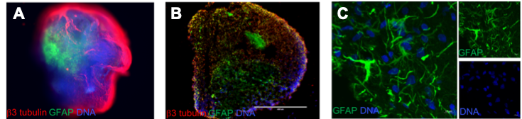 A-B) The cells labeled in red are neurons , the cells labeled in green are astrocytes , and the blue label indicates cellular DNA. Notice the distinct cells layers! C) This is a close up of astrocytes, a cell that helps maintain overall health in the brain. Notice their extended processes and star-like shape!
