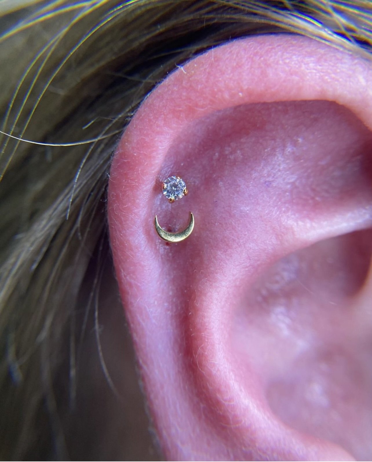 Dermal Piercing: Everything You Need To Know