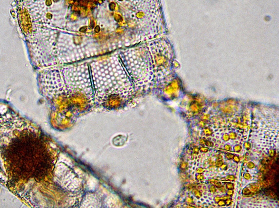 Choanoflagellates. 400x magnification. Brightfield.
.
Diatoms often steal the show, but if you pay attention to other cells in the field of view when doing microscopy, you can find some really interesting organisms. All diatoms in these photos have l