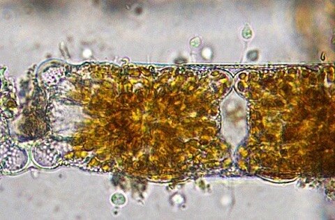 Choanoflagellates. 400x magnification. Brightfield.
.
Diatoms often steal the show, but if you pay attention to other cells in the field of view when doing microscopy, you can find some really interesting organisms. All diatoms in these photos have l