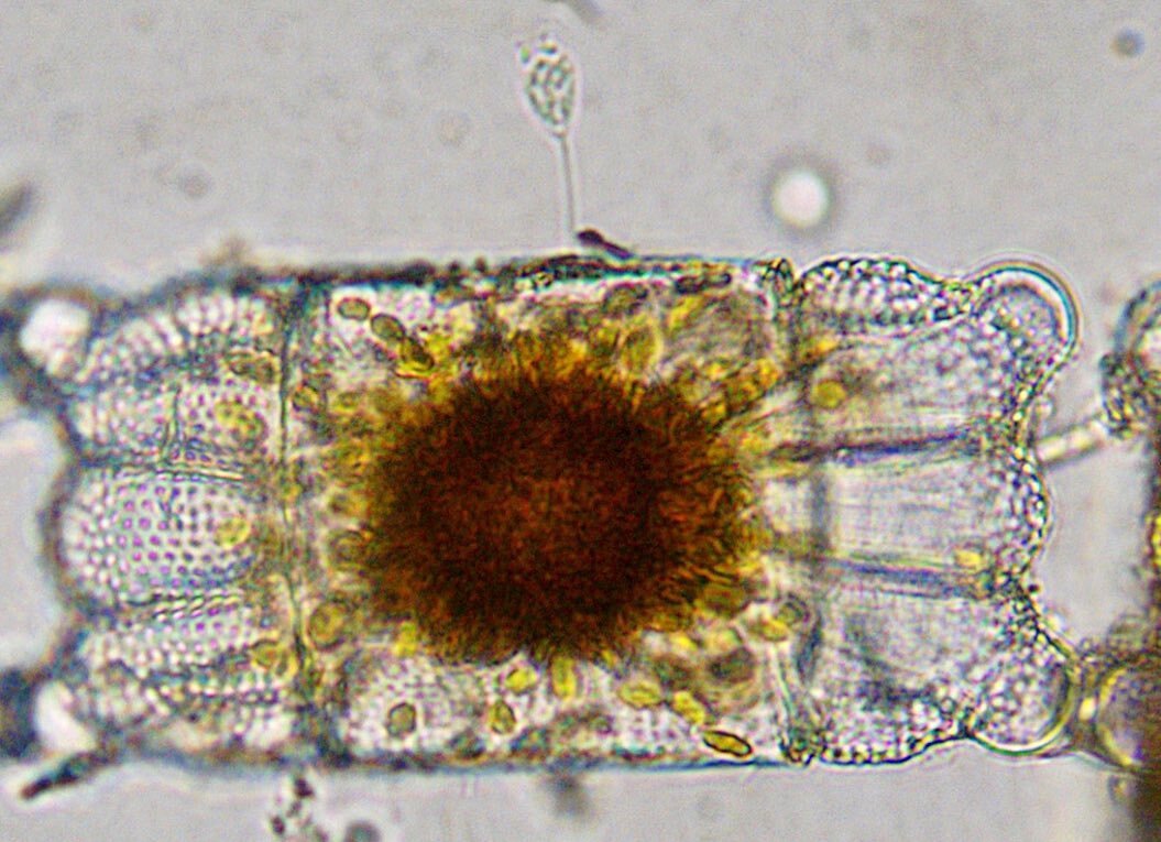 Choanoflagellates. 400x magnification. Brightfield.
.
Diatoms often steal the show, but if you pay attention to other cells in the field of view when doing microscopy, you can find some really interesting organisms. All diatoms in these photos have l