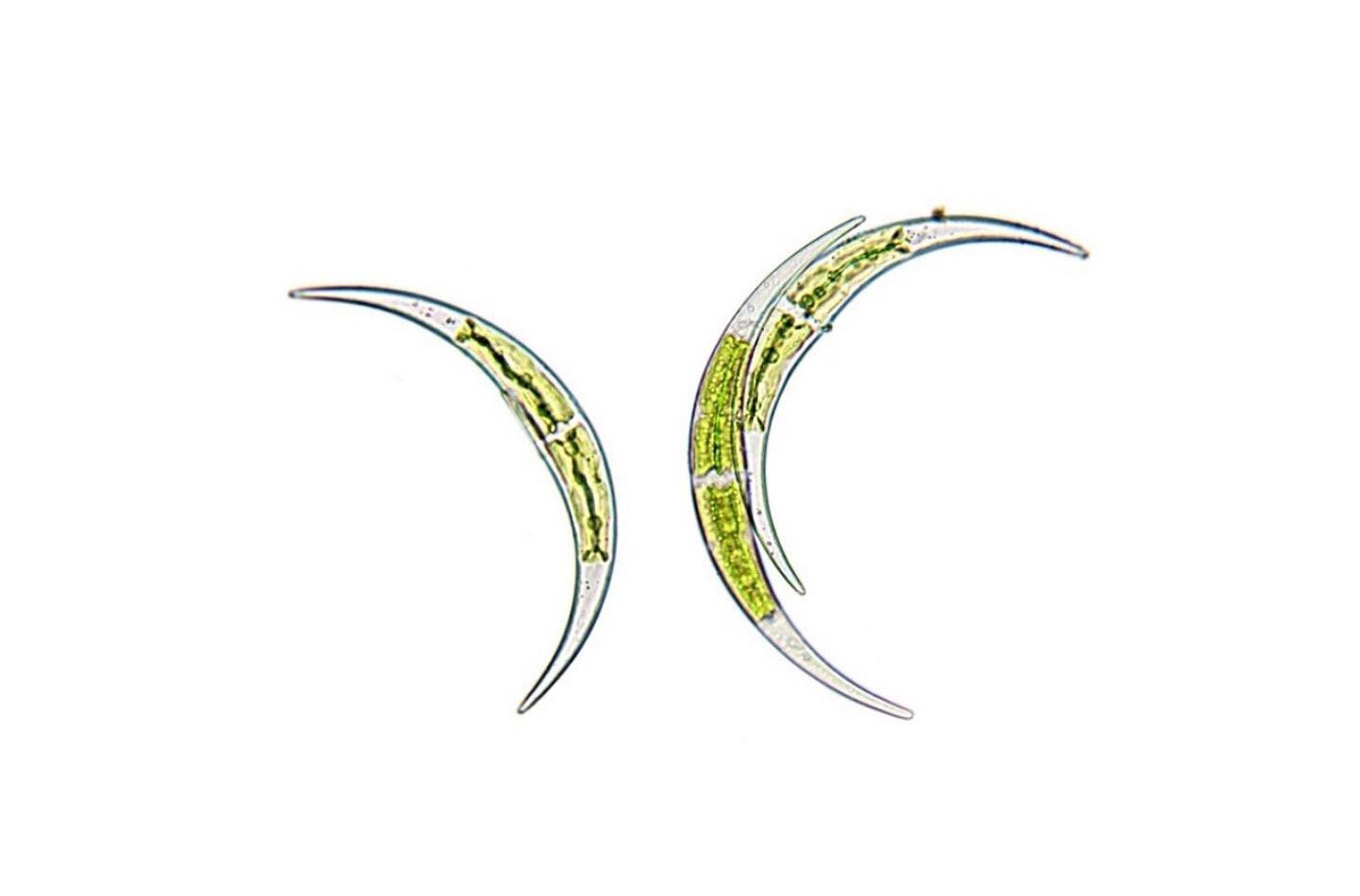Closterium sp. 400x magnification. Brightfield.
.
Closterium is a crescent or smile-shaped alga that is a member of the order Demidiales. Desmids are unicellular green algae (although some live in colonies/filaments) and they all have beautiful symme