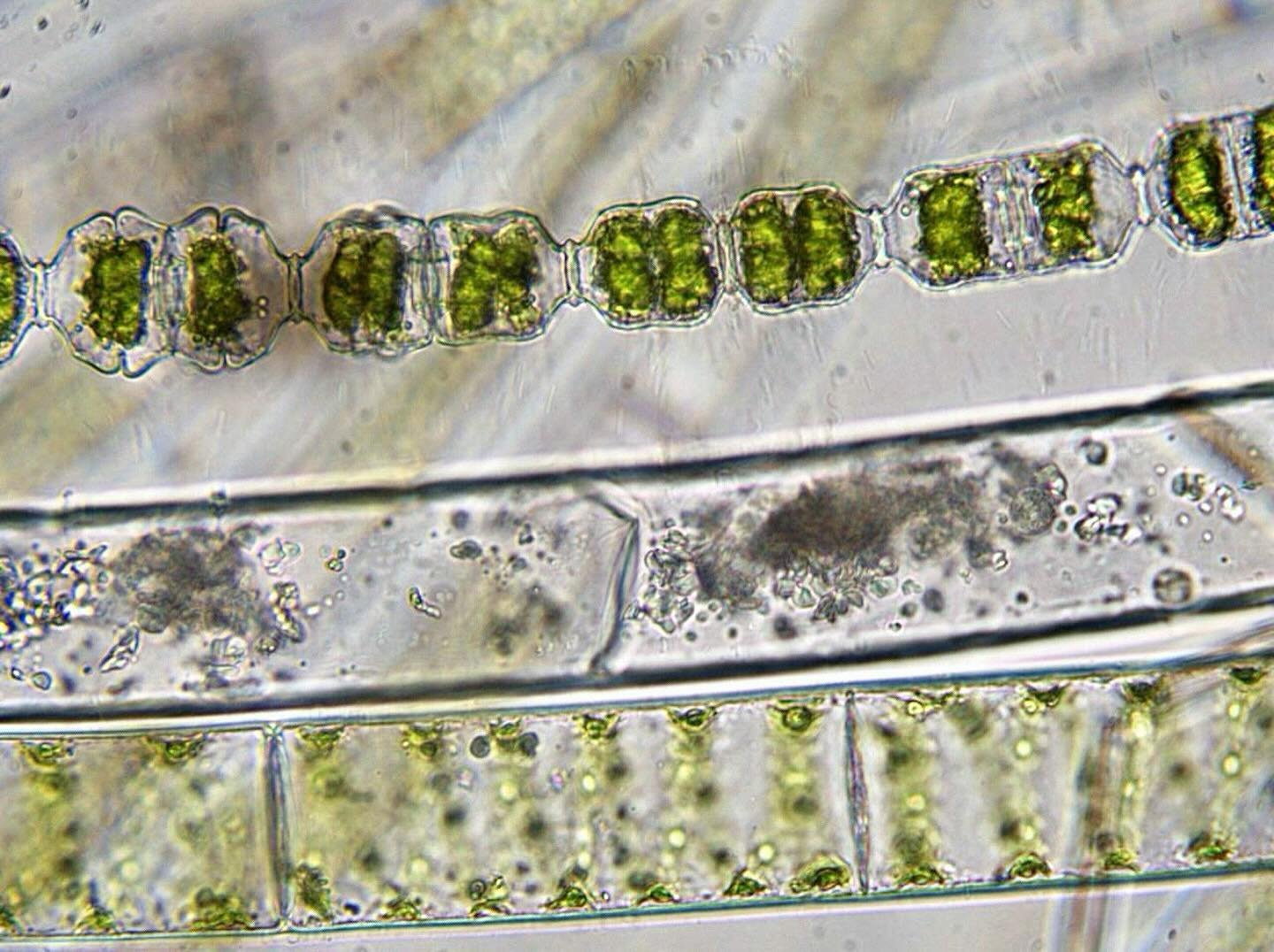 Filamentous green algae. 100x magnification. Brightfield.
.
I&rsquo;ll do another post in the future on complex multicellularity but here we have some good examples of algae with simple multicellularity. These cells exist as long filaments of many si